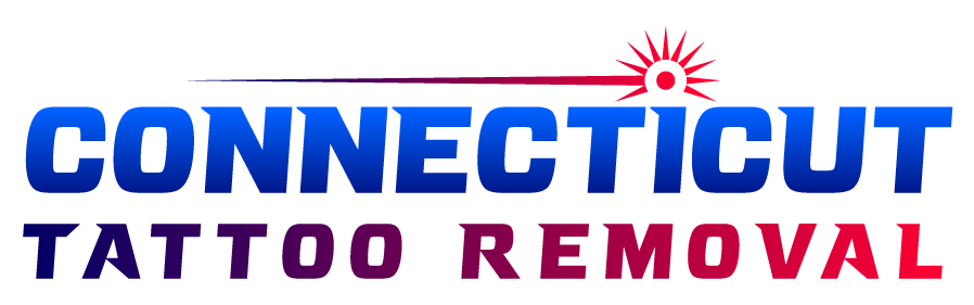 Connecticut-Tattoo-Removal-Logo
