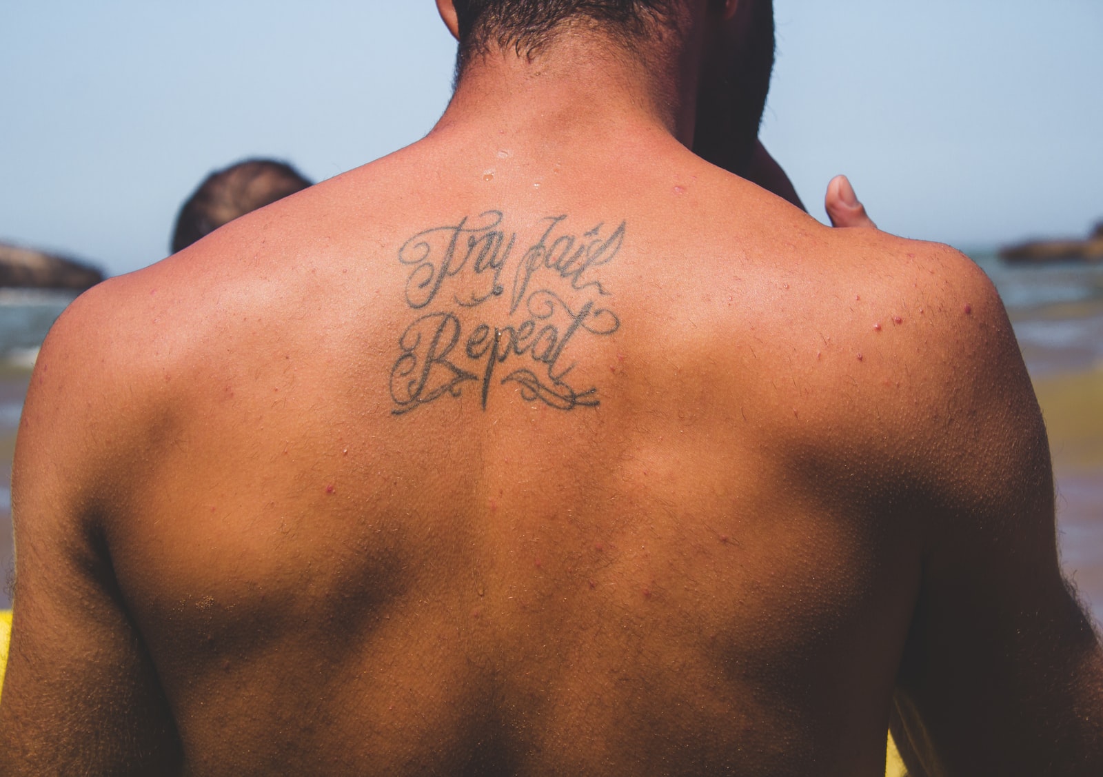 Sun Exposure and Tattoo Removal